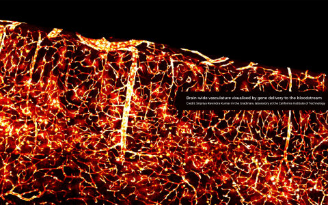 Brain-wide vasculature visualized by gene delivery to the bloodstream. Credit: Sripriya Ravindra Kumar in the Gradinaru laboratory at the California Institute of Technology 