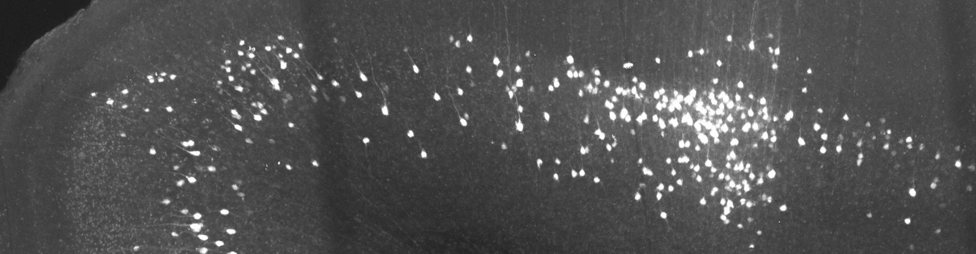 Presynaptic partners of primary visual cortical neurons extending to secondary visual and retrosplenial cortical regions