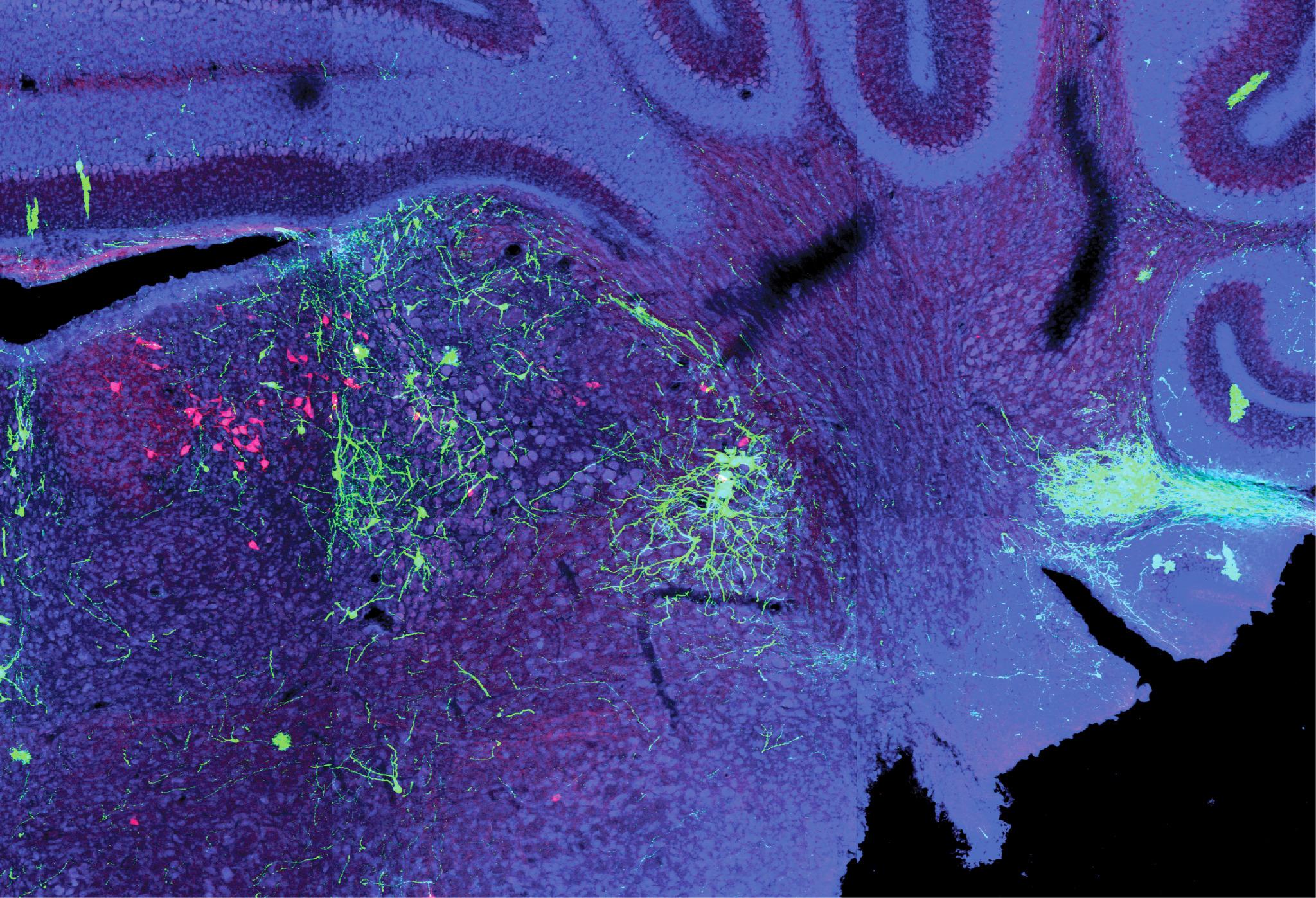 Medulla Mouse Brain Medulla Mouse Brain